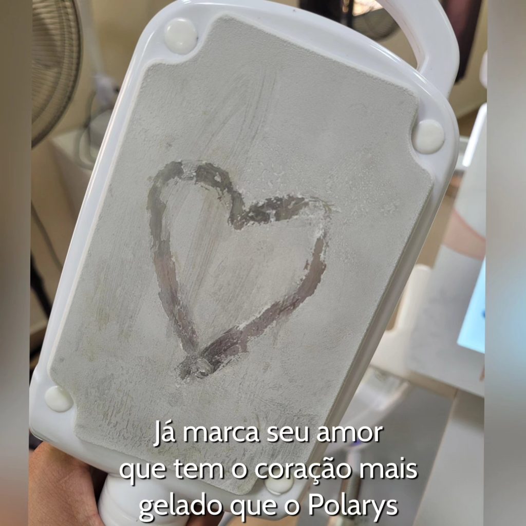 Imagem do Instagram relacionada ao post: Polarys da Ibramed: Locação de Criolipólise para Sua Clínica