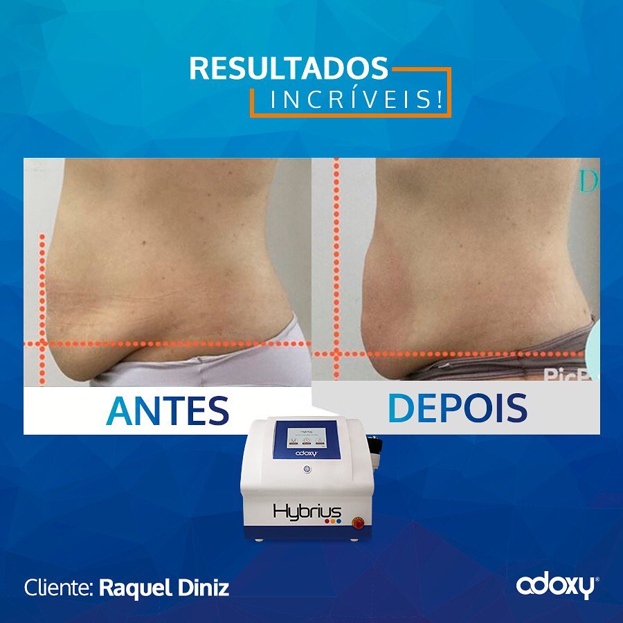 Imagem do Instagram relacionada ao post: Resultados Excepcionais com Equipamentos de Alta Qualidade