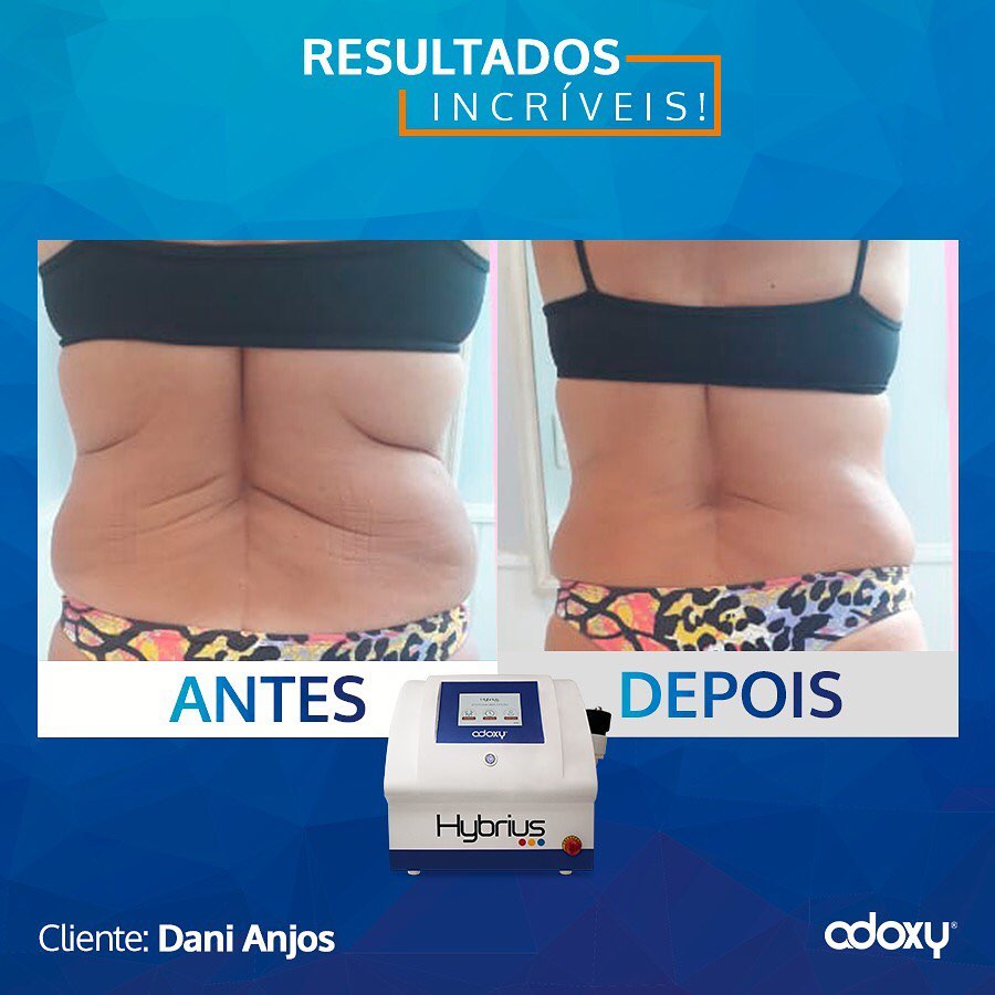 Imagem do Instagram relacionada ao post: Resultado impressionante com locação de equipamentos de alto padrão